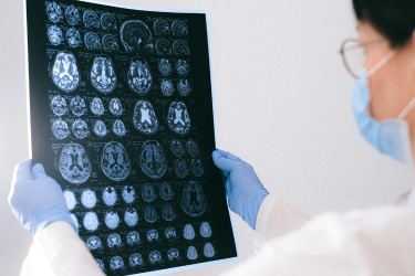 Participating in Alzheimer’s Disease and Related Dementias Research